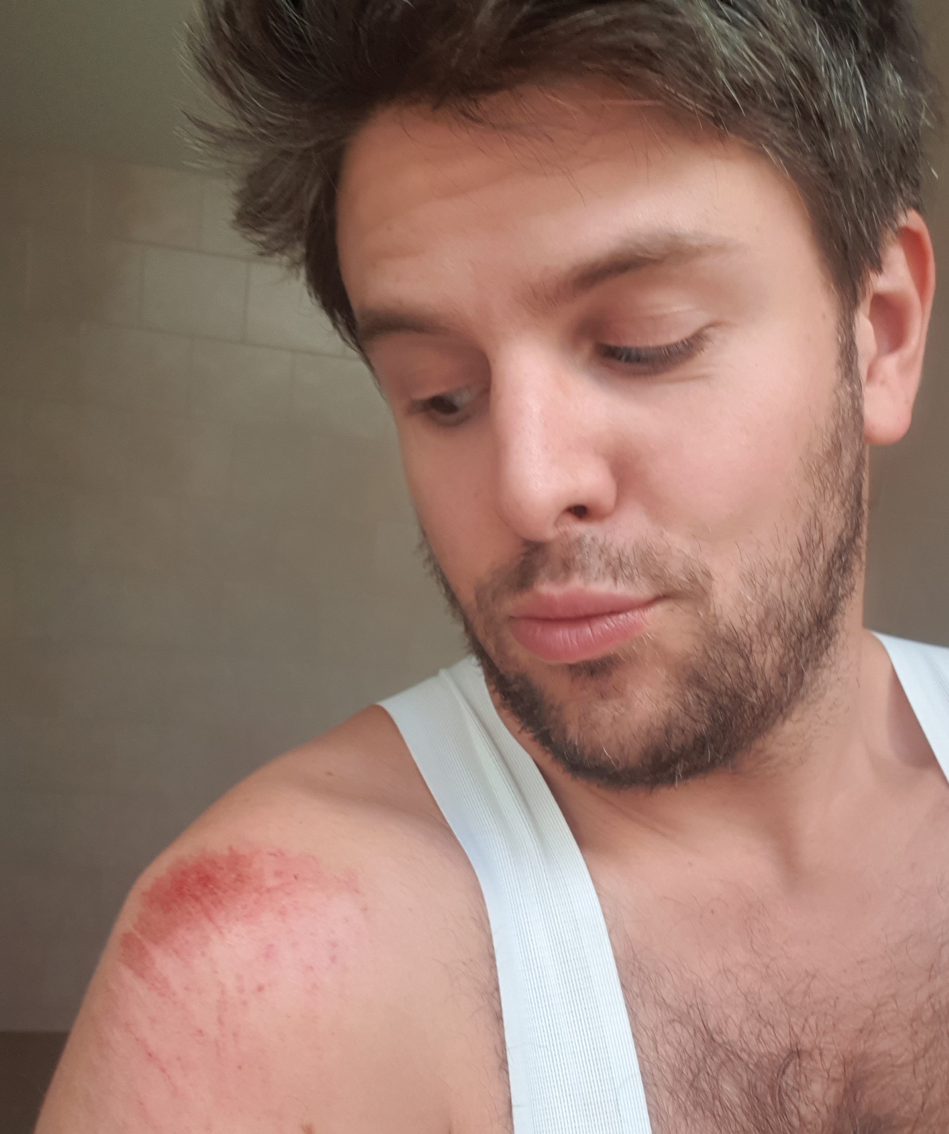 Modelling the new line of road rash